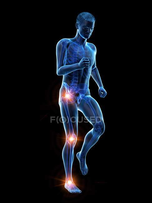 Silhueta de corredor masculino com dor nas articulações, ilustração conceitual . — Fotografia de Stock