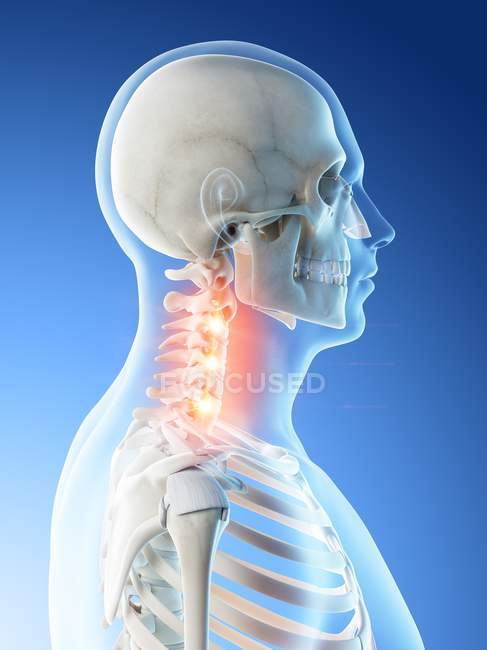 Cuerpo masculino abstracto con dolor de cuello detallado, ilustración digital conceptual
. - foto de stock