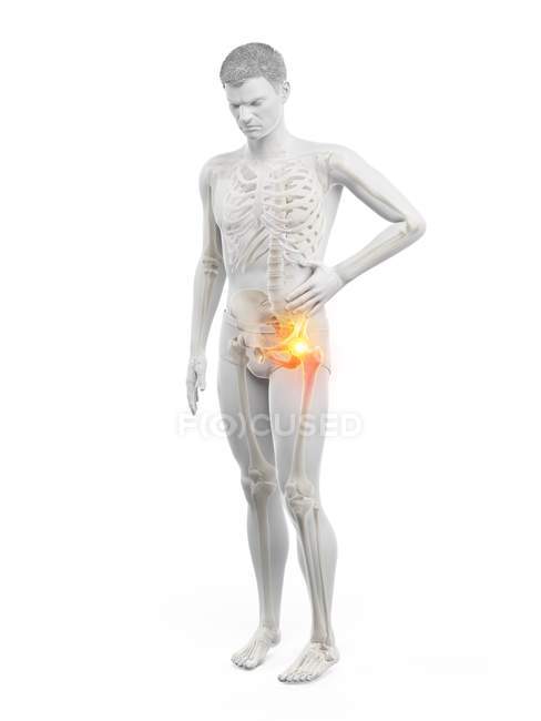 Silhouette eines Mannes mit Hüftschmerzen, digitale Illustration. — Stockfoto