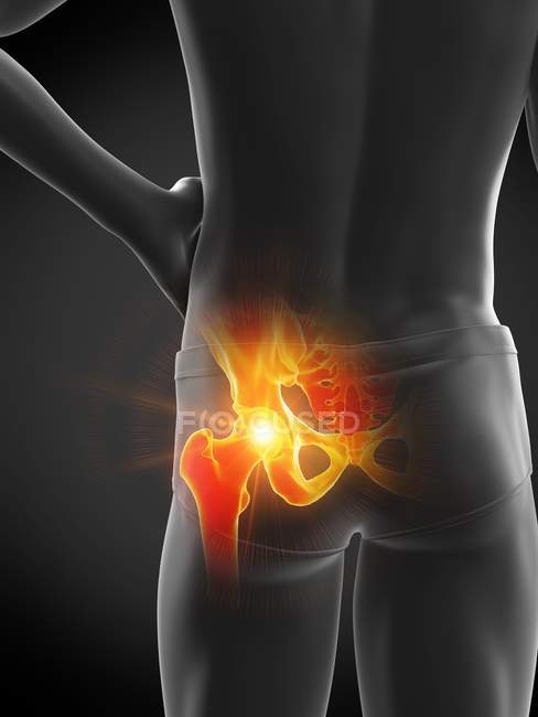 Silueta corporal masculina con dolor de cadera visible, ilustración digital . - foto de stock