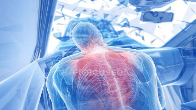 Ilustración de rayos X del riesgo de lesiones en la columna vertebral durante un accidente de tráfico frontal, ilustraciones digitales . - foto de stock