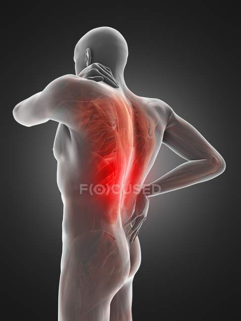 Silhouette du corps masculin avec douleurs musculaires et dorsales, illustration numérique . — Photo de stock