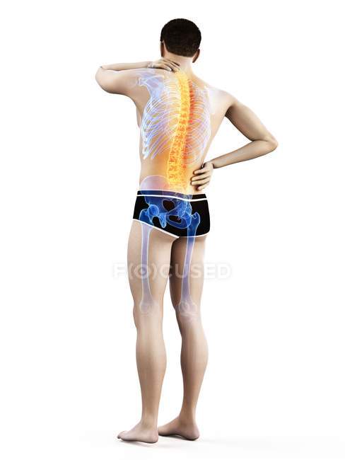 Cuerpo masculino con dolor de espalda en la vista trasera, ilustración conceptual
. — Stock Photo