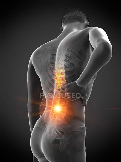 Мужской силуэт с болью в спине на черном фоне, концептуальная иллюстрация . — стоковое фото
