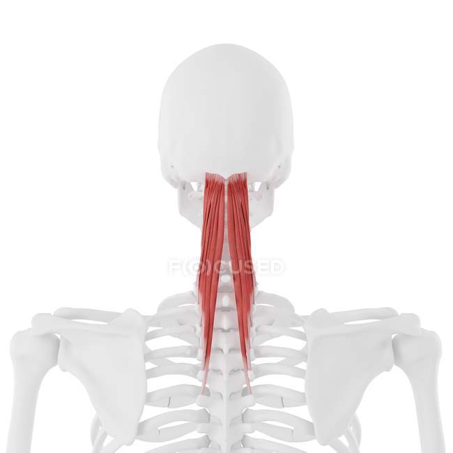 Esqueleto humano com vermelho colorido músculo Semispinalis capitis, ilustração digital . — Fotografia de Stock