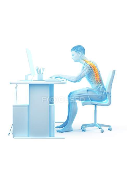 Боль в спине офисного работника, сидящего и работающего за столом, концептуальная иллюстрация . — стоковое фото
