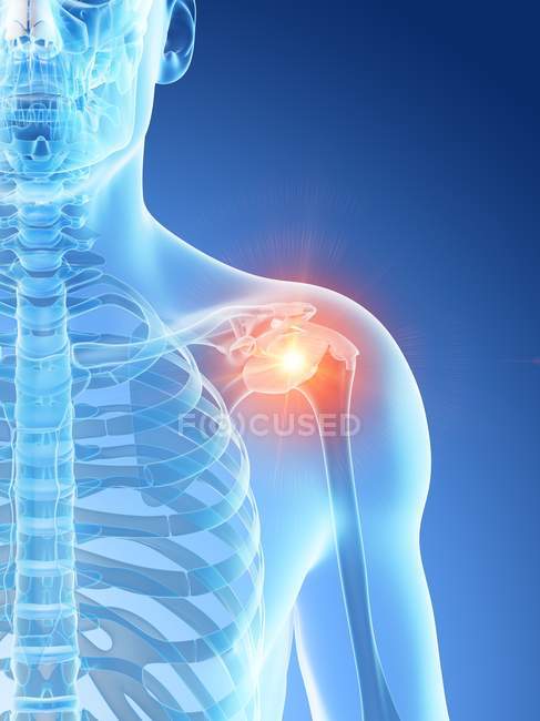 Абстрактное мужское тело с подробной болью в плече, концептуальная цифровая иллюстрация . — стоковое фото