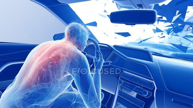 Ilustración de rayos X del riesgo de lesiones en la columna vertebral durante un accidente de tráfico frontal, ilustraciones digitales
. - foto de stock
