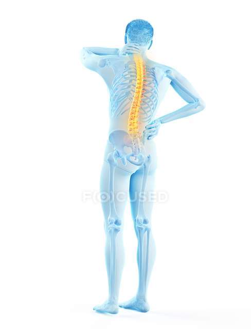 Вид ззаду чоловічого тіла з болем у спині, концептуальна ілюстрація . — стокове фото