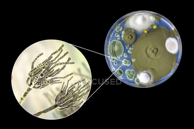 Colonies of Penicillium fungi grown on Sabouraud Dextrose Agar and digital illustration of fungal morphology. — Stock Photo