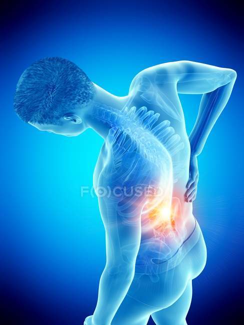 Высокий угол обзора изгиба мужского тела с болью в спине, концептуальная иллюстрация . — стоковое фото