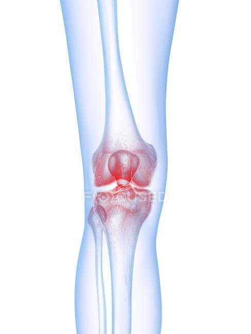Абстрактний силует людини з болем коліна, концептуальний приклад. — стокове фото