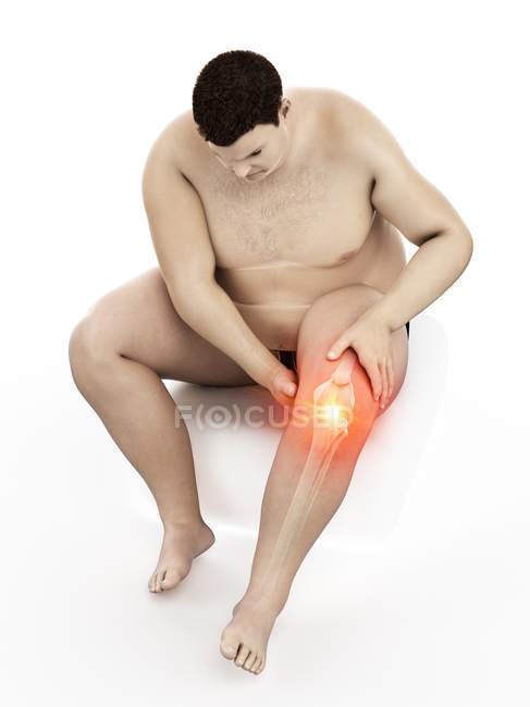 Silueta del hombre obeso sentado que tiene dolor de rodilla, ilustración por computadora . - foto de stock