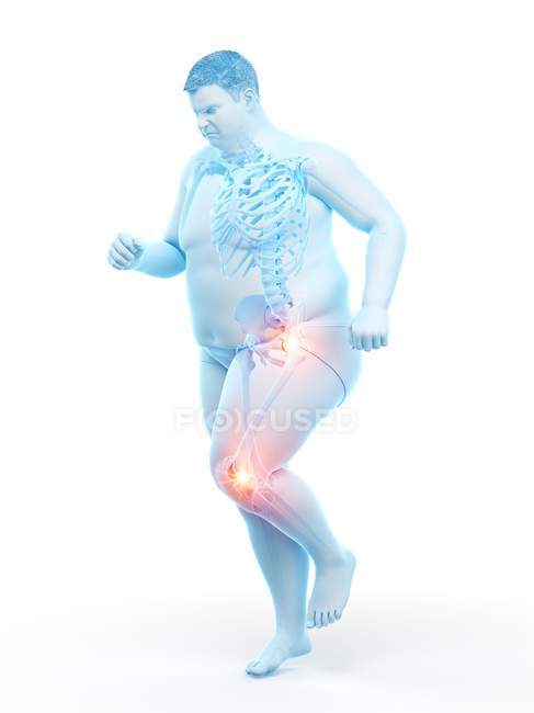 Silueta de hombre obeso corriendo con dolor en las articulaciones, ilustración por computadora . - foto de stock