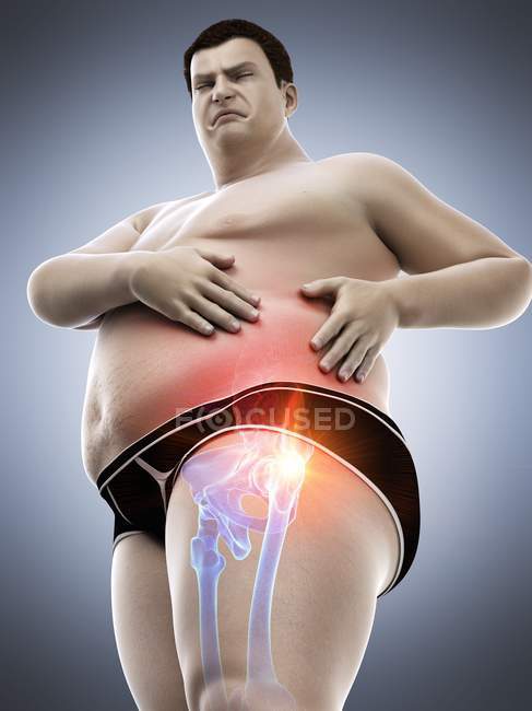 Silhouette d'homme obèse avec douleur à la hanche, illustration numérique . — Photo de stock