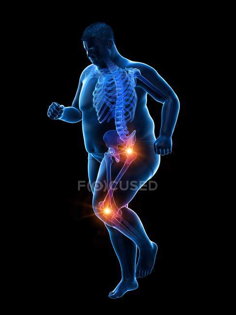 Silueta de hombre obeso corriendo con dolor en las articulaciones, ilustración por computadora . - foto de stock