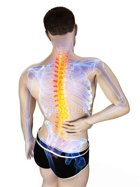 Male body with back pain in high angle view, conceptual illustration. — Stock Photo