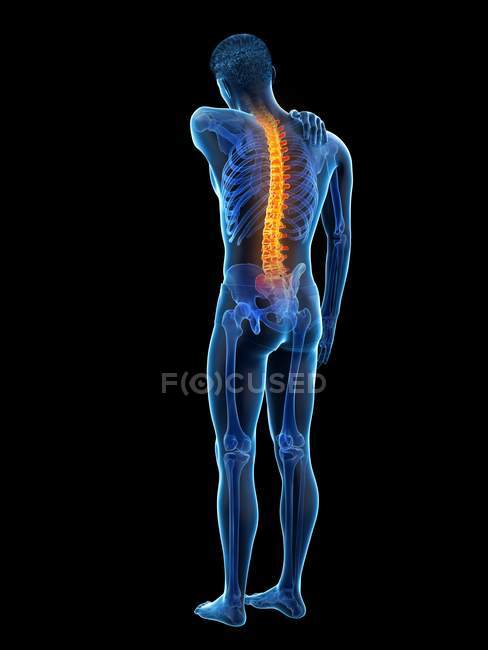 Back pain, conceptual illustration. — Stock Photo