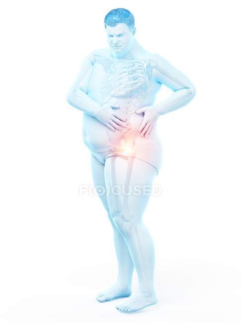 Силуэт толстяка с болью в бедре, цифровая иллюстрация . — стоковое фото