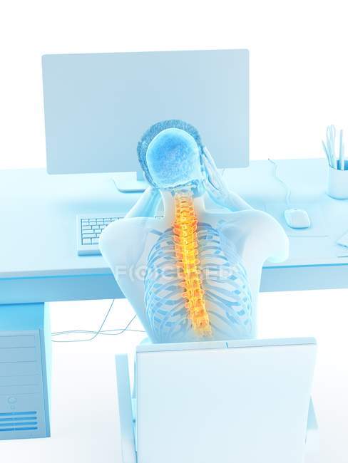 Стрессовый офисный работник с болью в спине на заднем плане, концептуальная иллюстрация . — стоковое фото