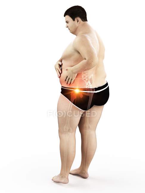 Silhouette of obese man with hip pain, digital illustration. — Stock Photo