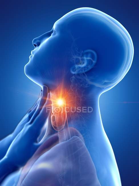 Corpo masculino abstrato com dor de garganta em fundo azul, ilustração digital conceitual . — Fotografia de Stock