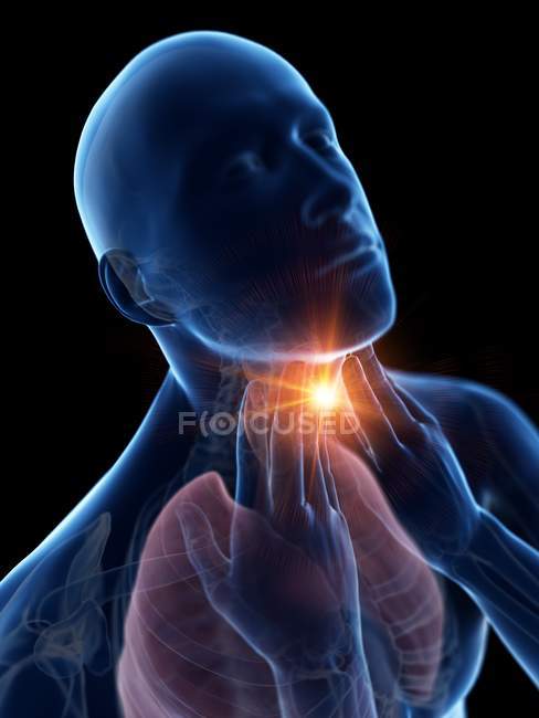 Cuerpo masculino abstracto con dolor de garganta sobre fondo negro, ilustración digital conceptual . - foto de stock