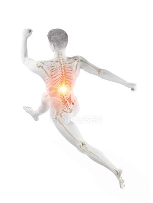 Silueta de corredor masculino con dolor de espalda en vista de ángulo alto, ilustración conceptual . - foto de stock