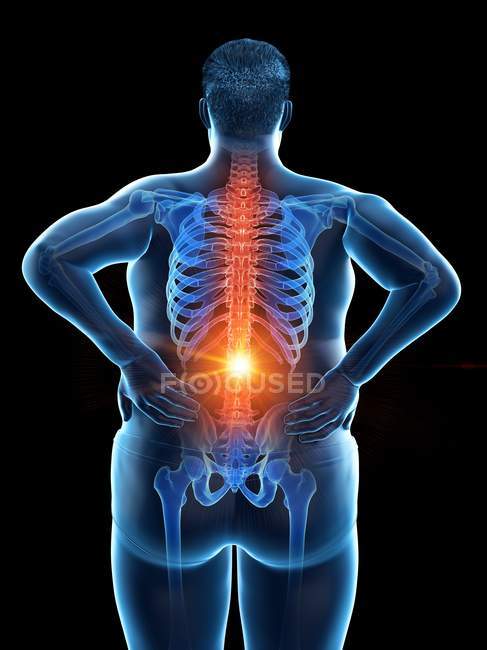 Vista trasera del cuerpo masculino obeso con dolor de espalda, ilustración digital . - foto de stock
