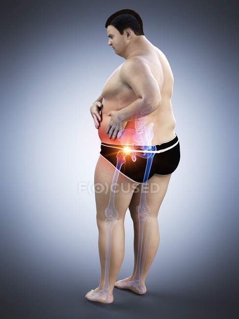 Силует здорового чоловіка з болем у стегні, цифрова ілюстрація . — стокове фото