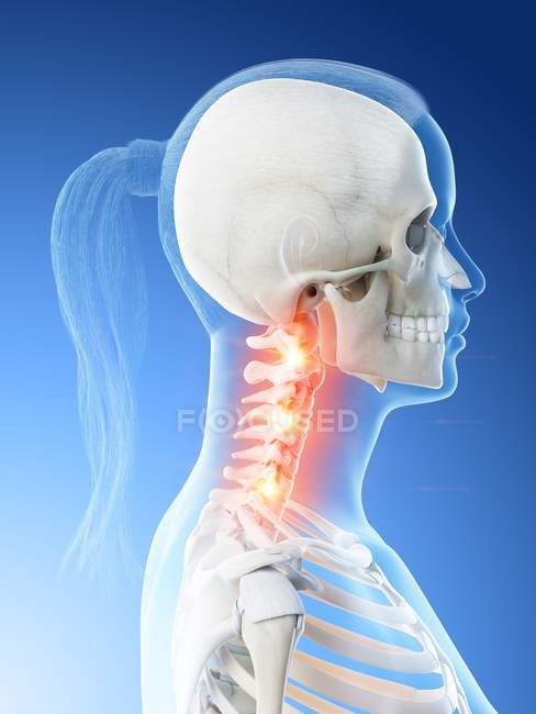 Corpo femminile astratto con dolore al collo dettagliato, illustrazione digitale concettuale . — Foto stock