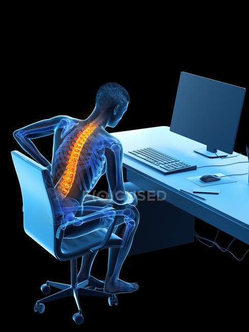 Male office worker with back pain due to sitting, conceptual illustration. — Stock Photo