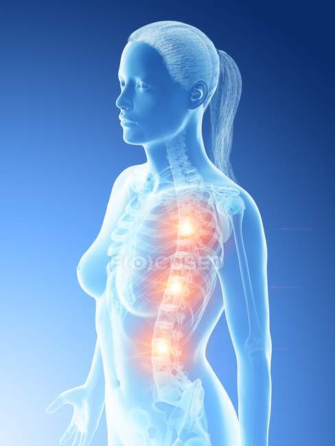 Weibliche Silhouette mit glühenden Rückenschmerzen, konzeptionelle digitale Illustration. — Stockfoto