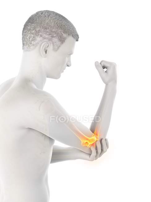Cuerpo masculino abstracto con dolor de codo visible, ilustración conceptual
. - foto de stock