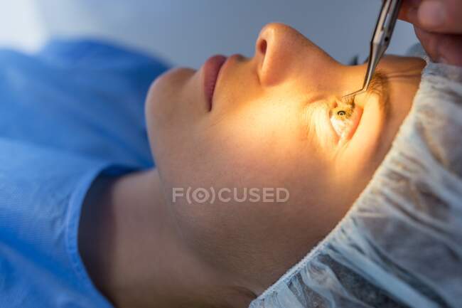Пациент, проходящий лазерную операцию глаза. — стоковое фото