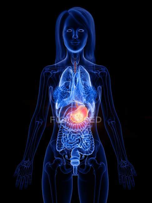 Рак желудка в женском теле, концептуальная компьютерная иллюстрация . — стоковое фото