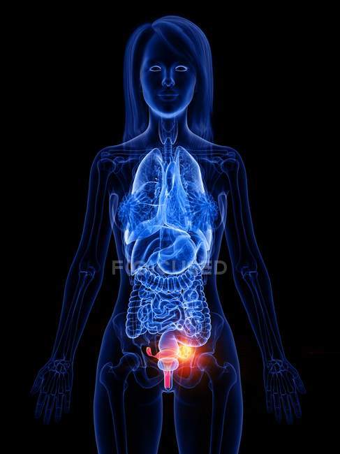 Cancer de l'utérus dans le corps féminin, illustration conceptuelle par ordinateur
. — Photo de stock