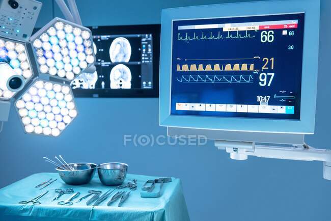 Equipamentos cirúrgicos e monitores. — Fotografia de Stock