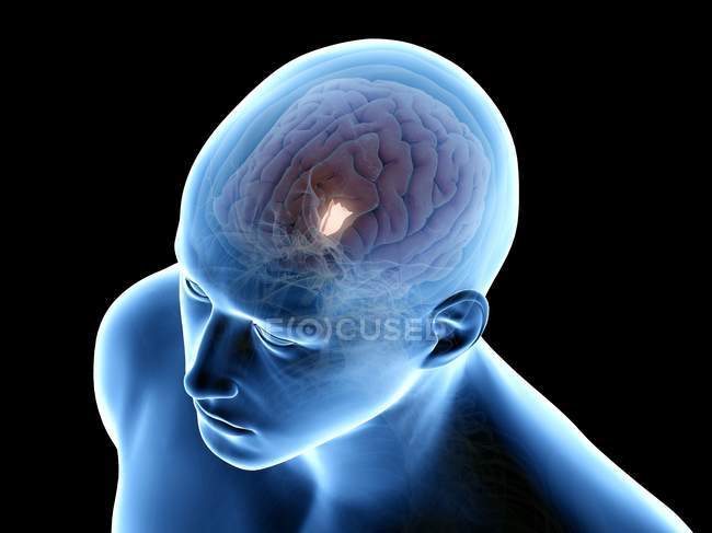 Corps humain avec hypothalamus détaillé dans le cerveau, illustration par ordinateur . — Photo de stock