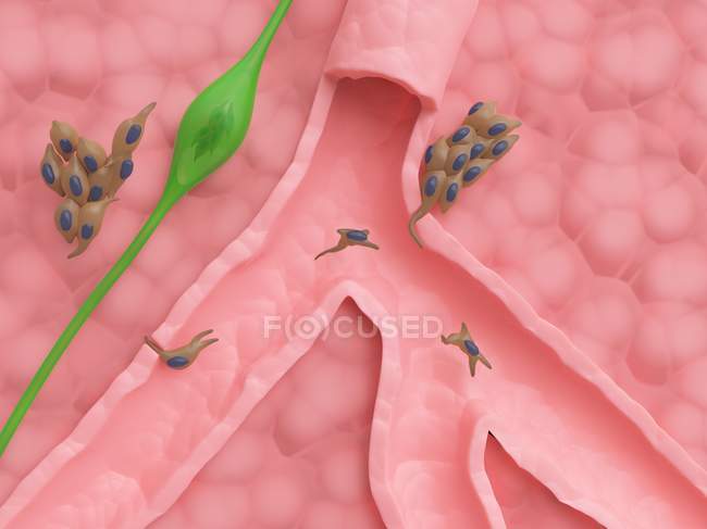 Difusión de células cancerosas, ilustración por computadora
. - foto de stock