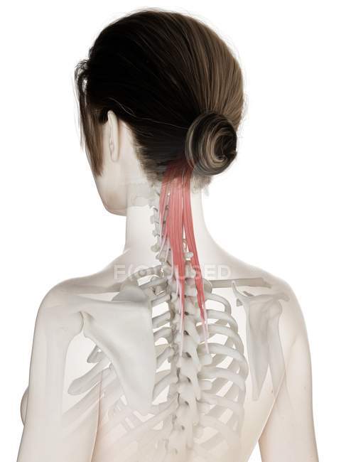 Weibliches Körpermodell mit rot gefärbtem Semispinalis capitis Muskel, Computerillustration. — Stockfoto