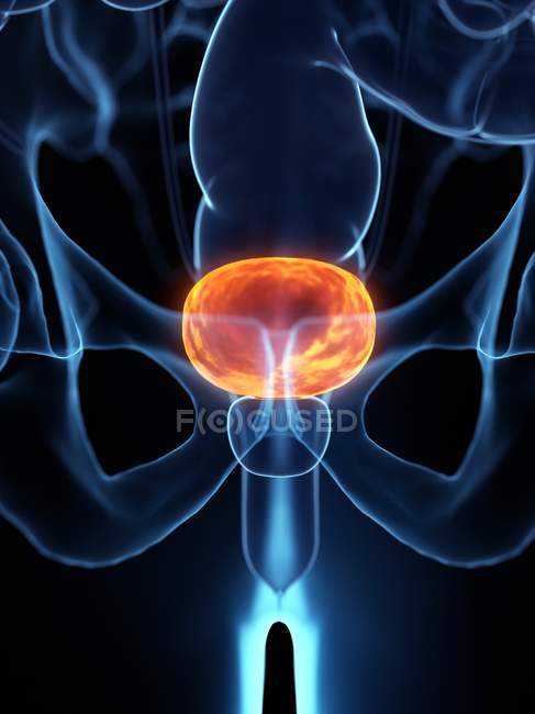 Diseased bladder in abstract human body, conceptual digital illustration. — Stock Photo