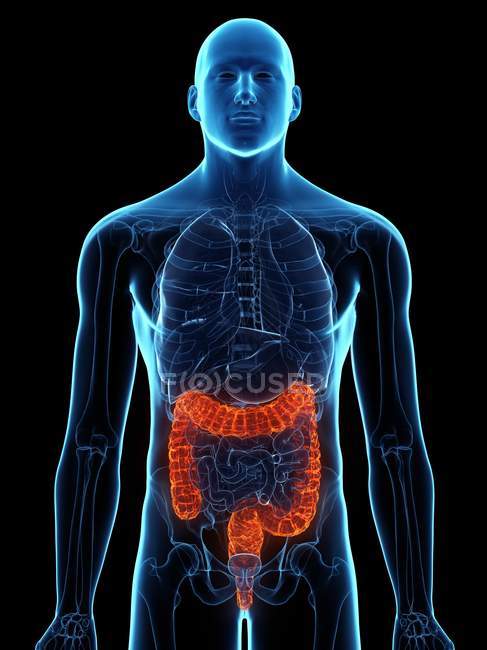 Cuerpo masculino con colon enfermo, ilustración por computadora
. - foto de stock
