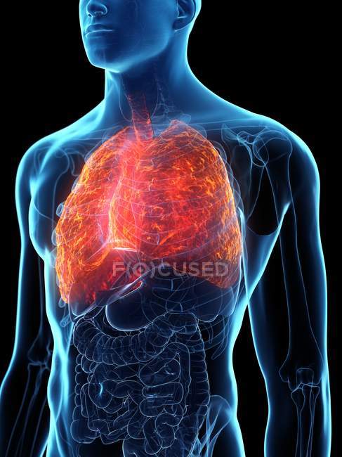 Kranke Lungen im transparenten Männerkörper auf schwarzem Hintergrund, Computerillustration. — Stockfoto