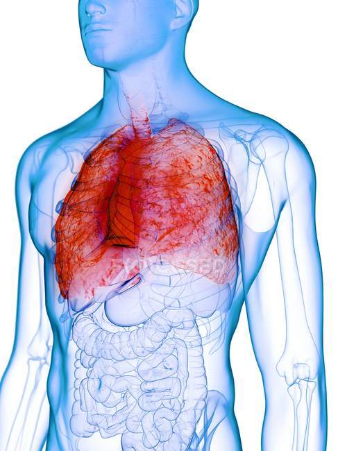 Pulmones enfermos en cuerpo masculino transparente sobre fondo blanco, ilustración por computadora
. - foto de stock