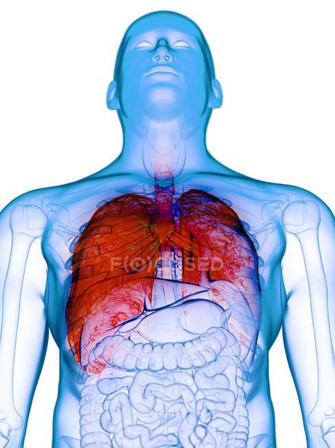 Kranke Lungen im transparenten Männerkörper auf weißem Hintergrund, Computerillustration. — Stockfoto