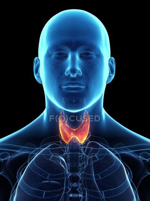 Male silhouette with diseased thyroid gland, conceptual illustration. — Stock Photo