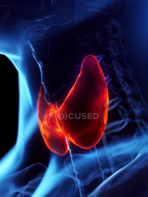 Diseased thyroid gland, conceptual computer illustration. — Stock Photo