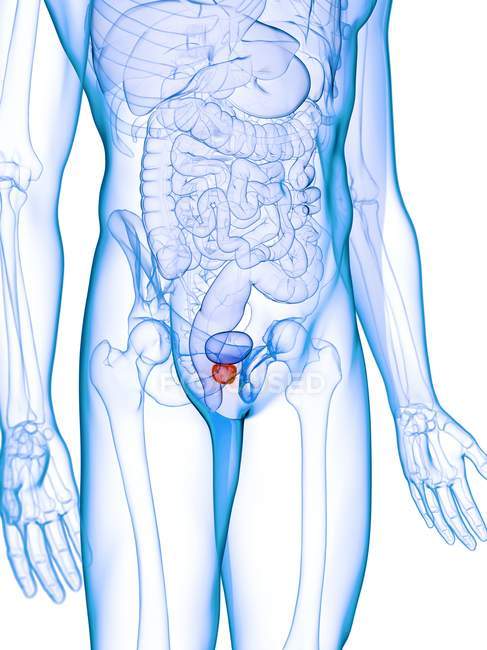 Próstata inflamada em corpo masculino abstrato, ilustração digital . — Fotografia de Stock