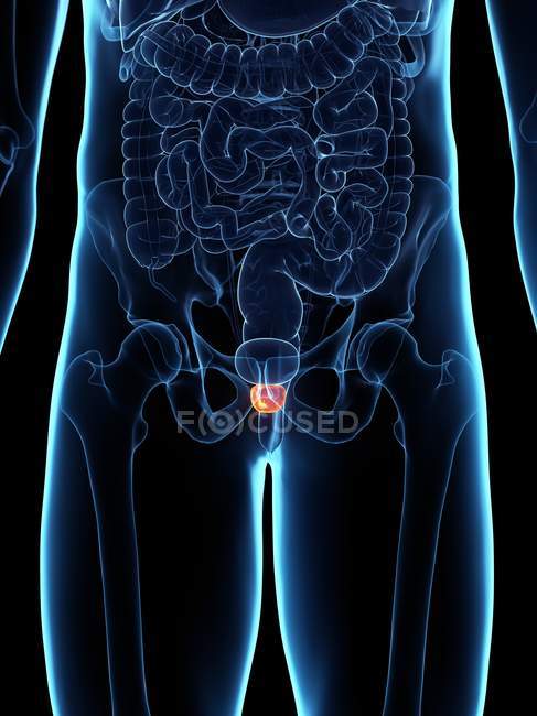 Entzündete Prostata im abstrakten männlichen Körper, digitale Illustration. — Stockfoto